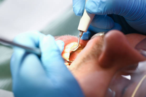 Best Emergency Tooth Extraction  in Lewisburg, OH